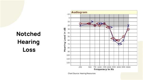 mid frequency hearing loss test